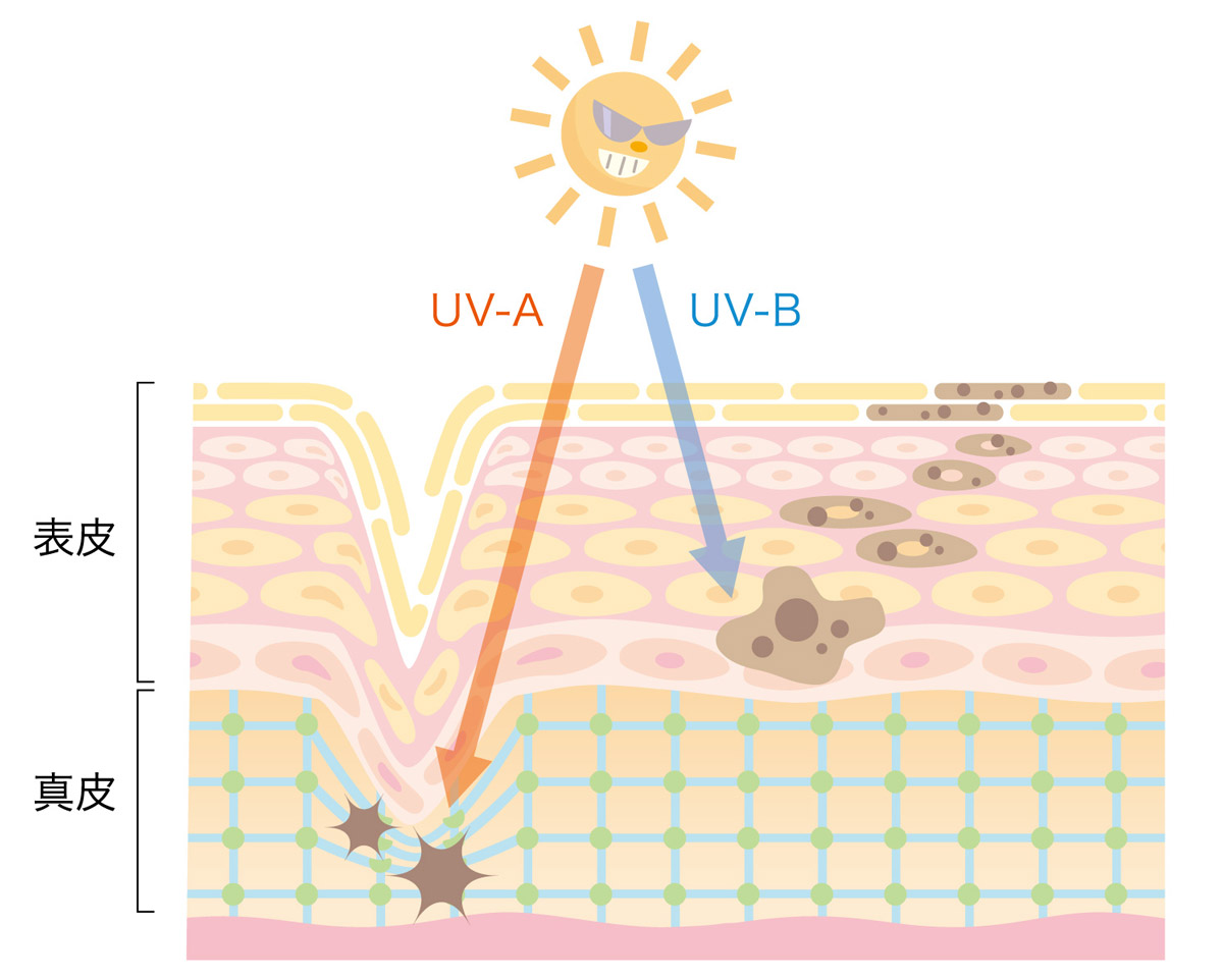 紫外線　乾燥肌