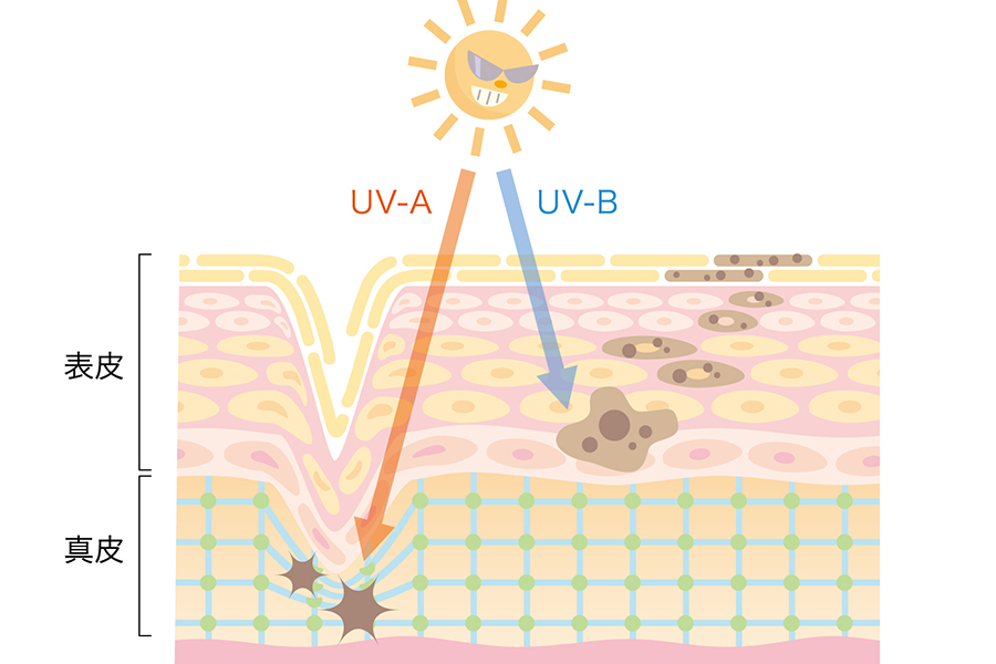 日焼け　乾燥肌